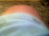 My knee