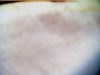 Texturized
