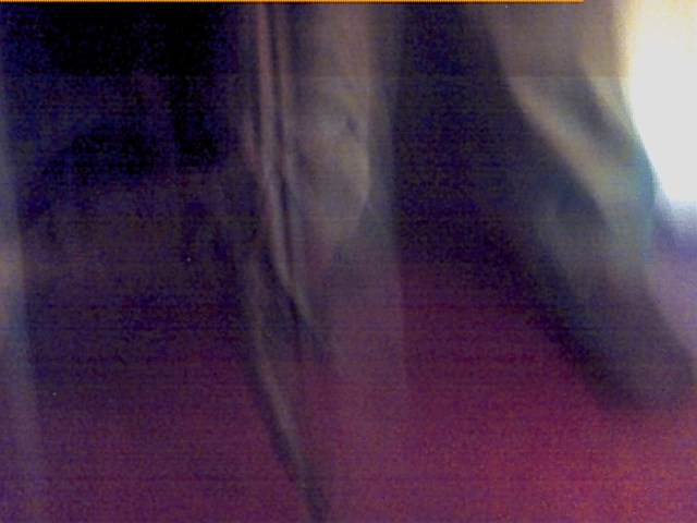 Thing