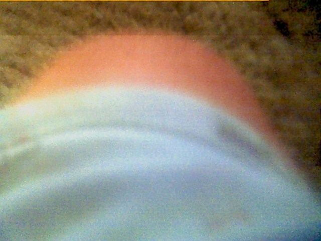 My knee