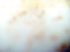 Spottled #5